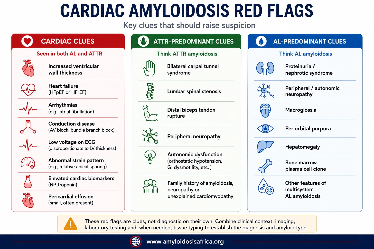 Medical infographic showing cardiac amyloidosis red flags, including shared cardiac clues such as increased ventricular wall thickness, heart failure, arrhythmias, conduction disease, low ECG voltage, abnormal strain pattern, elevated cardiac biomarkers and pericardial effusion; ATTR-predominant clues including bilateral carpal tunnel syndrome, lumbar spinal stenosis, distal biceps tendon rupture, peripheral neuropathy and autonomic dysfunction; and AL-predominant clues including proteinuria, nephrotic syndrome, peripheral or autonomic neuropathy, macroglossia, periorbital purpura and hepatomegaly.