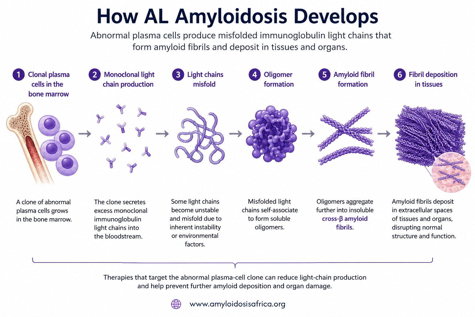 AL amyloidosis infographic showing clonal plasma cells producing monoclonal light chains that misfold, form oligomers and amyloid fibrils, and deposit in tissues and organs.
