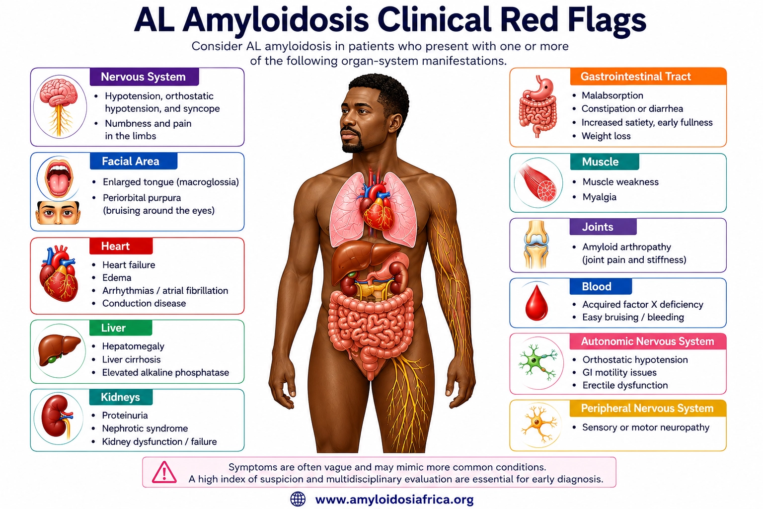 AL amyloidosis clinical red flags infographic showing cardiac, renal, neurologic, gastrointestinal, liver, muscle, joint, blood, autonomic, and soft-tissue manifestations including macroglossia and periorbital purpura.