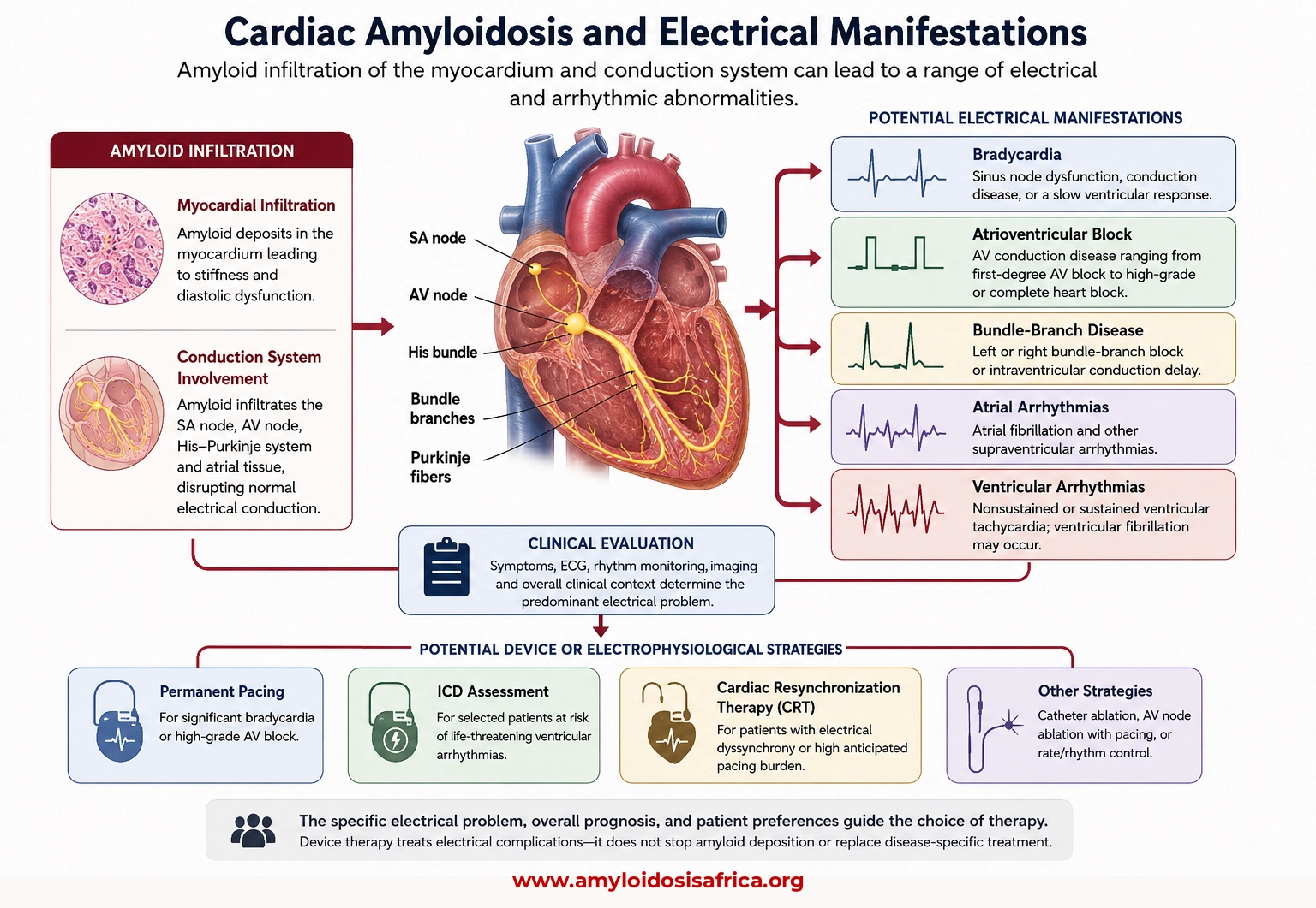 Cardiac amyloidosis electrical manifestations showing bradycardia, AV block, bundle-branch disease, atrial and ventricular arrhythmias, and device therapy options.