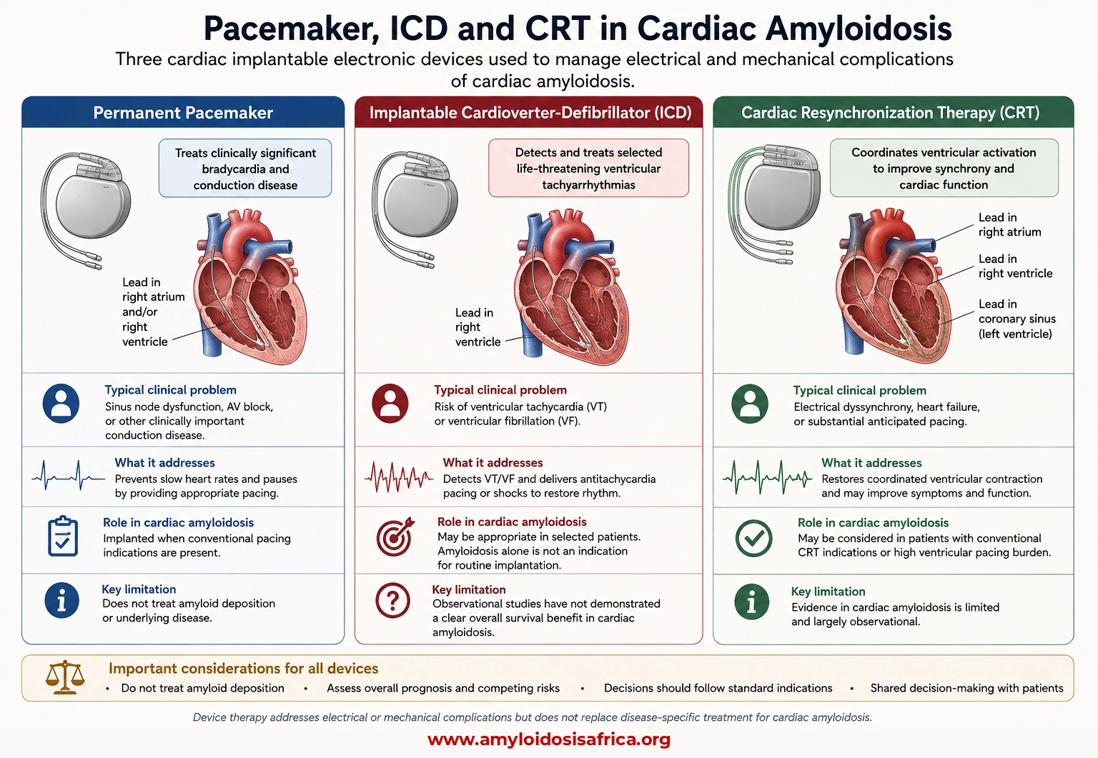 Pacemaker, ICD and CRT in cardiac amyloidosis showing device roles in bradycardia, conduction disease, ventricular arrhythmias and cardiac resynchronization.