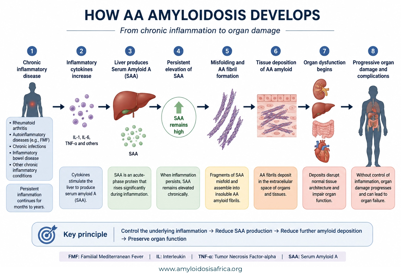 How AA amyloidosis develops from chronic inflammation, showing increased inflammatory cytokines, liver production and persistent elevation of serum amyloid A (SAA), AA amyloid fibril formation, tissue deposition, organ dysfunction, and progressive organ damage.