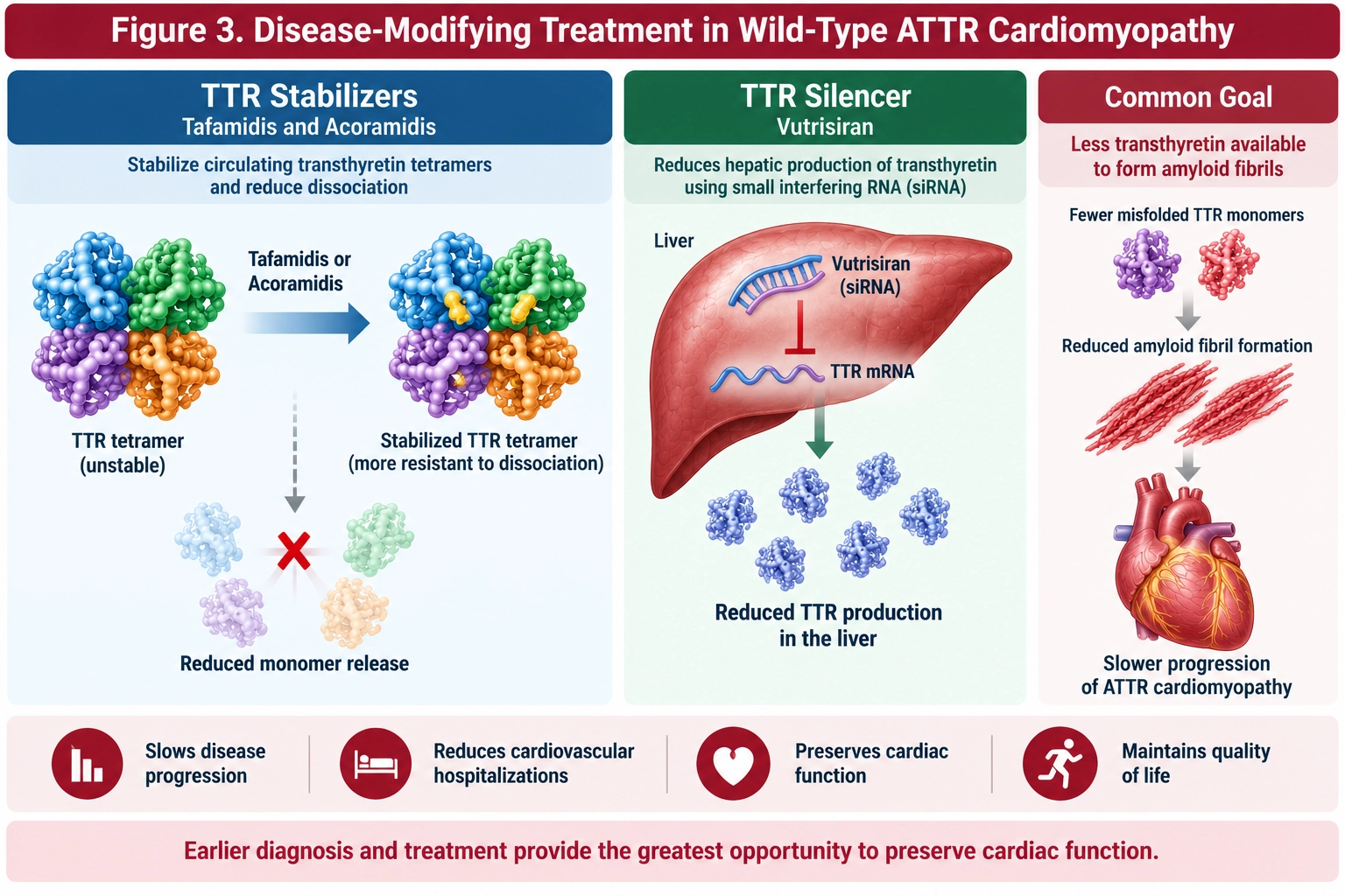 Disease-modifying treatment for wild-type ATTR cardiomyopathy showing tafamidis and acoramidis stabilizing transthyretin tetramers and vutrisiran reducing TTR production in the liver