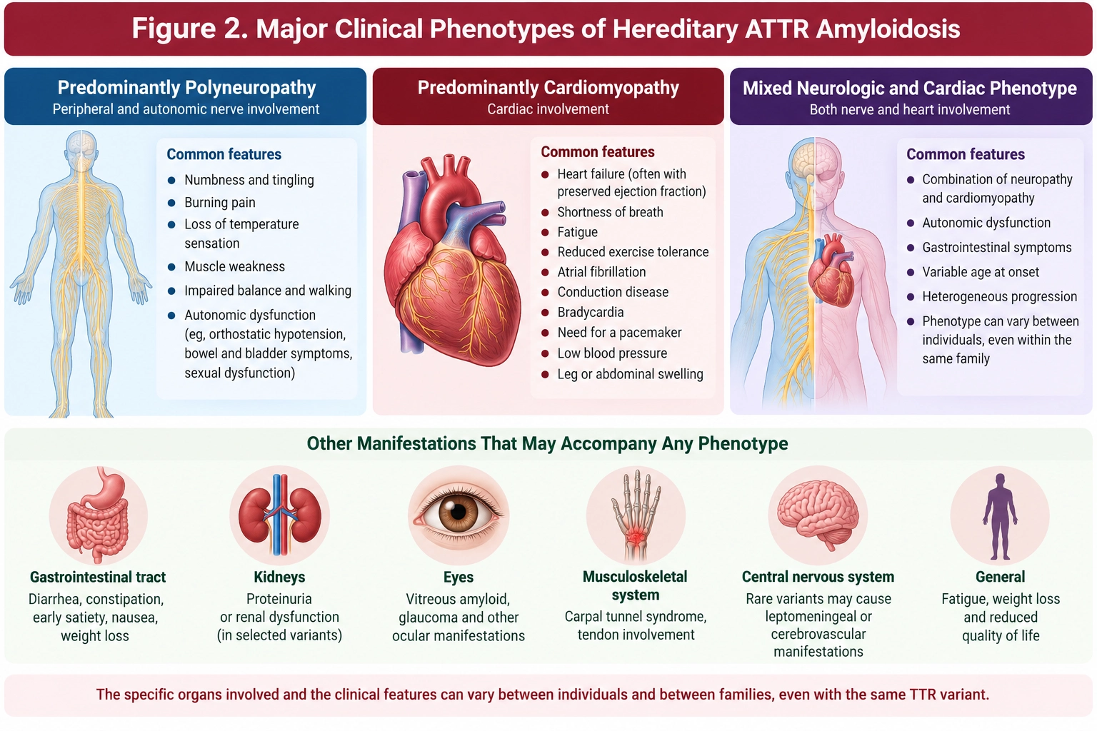 Hereditary ATTR amyloidosis clinical phenotypes showing polyneuropathy, cardiomyopathy and mixed neurologic and cardiac involvement with other systemic manifestations